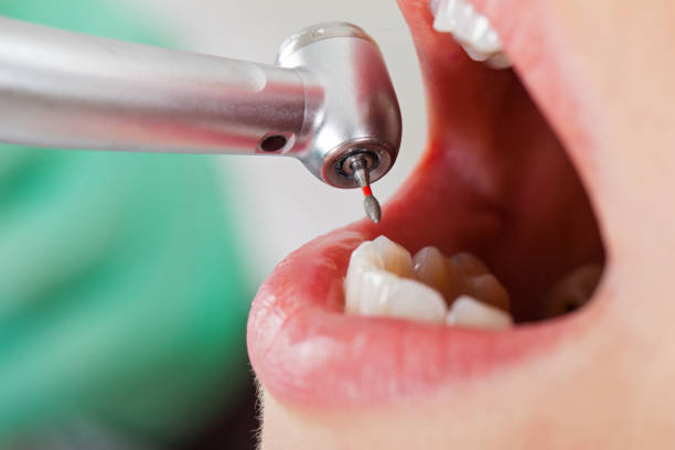 Best Emergency Broken Tooth Repair in Cheboygan, MI